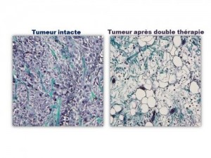 Masson's trichrome staining: the cell nuclei are blue-black, the cytoplasms (cell bodies) are mauve and the collagen fibers are green. Credit: CNRS/Université Paris Diderot